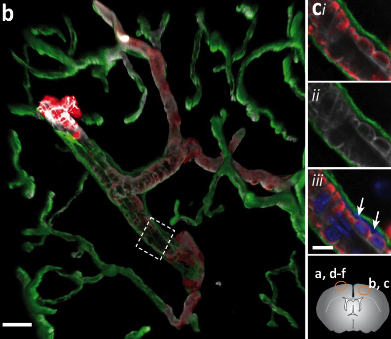 CNS perivascular space – laminin α2 (green), laminin α5 (white), SMA (red), DAPI (blue)